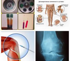 11401508_732626403529877_6519910980825142363_n