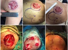 15094278_1044347412357773_1730513697318316428_n