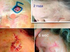 18446972_1230007010458478_3806629280918730298_n