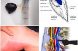 21231703_1330895830369595_1767009661601686448_n