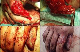 29066695_1504241479701695_7133820900608049152_n